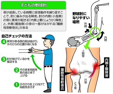 枚方市で野球肘でお悩みならBorn body鍼灸整骨院にご相談ください。